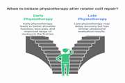 Early versus late physiotherapy following arthroscopic repair of small and medium size rotator cuff tear: a randomized clinical trial